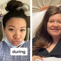 Als Schwangerschaftsnase wird eine Nase beschrieben, die während der Schwangerschaft größer wird. Zwei Frauen zeigen auf TikTok ihre Schwangerschaftsnase.