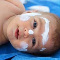 Babys und Kleinkinder sind besonders anfällig für Hitzepickel. Je heller der Hauttyp desto eher.