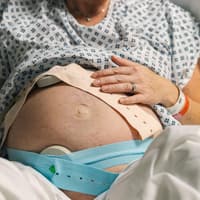 Ein Scheidenriss kann schmerzhaft sein, trotzdem müssen Schwangere keine Angst davor haben. Schwangere Frau mit CTG.