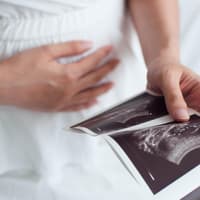 Auch Ultraschallbilder finden in einer Mutterpasshülle Platz. Schwangere Frau mit Ultraschallbildern.