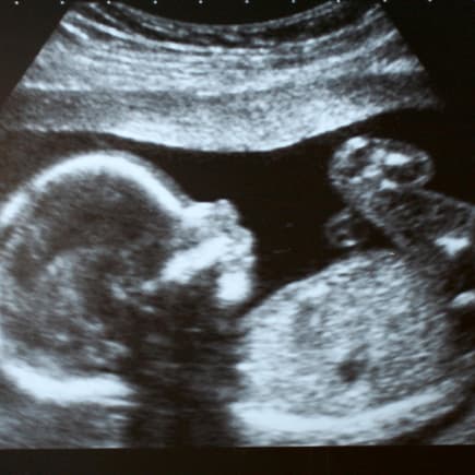 Schon im Bauch der Mutter entwickeln Babys faszinierende Fähigkeiten. Ultraschallbild eines Babys.