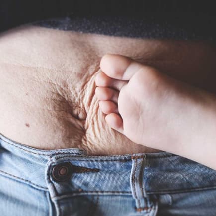 Ja, genau so darf ein After-Baby-Bauch aussehen. Kinderfuß an faltigem Mama-Bauch.