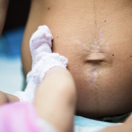 Aus bestimmten Gründen ist es gar nicht möglich, dass der Bauch nach der Geburt gleich wieder flach ist.