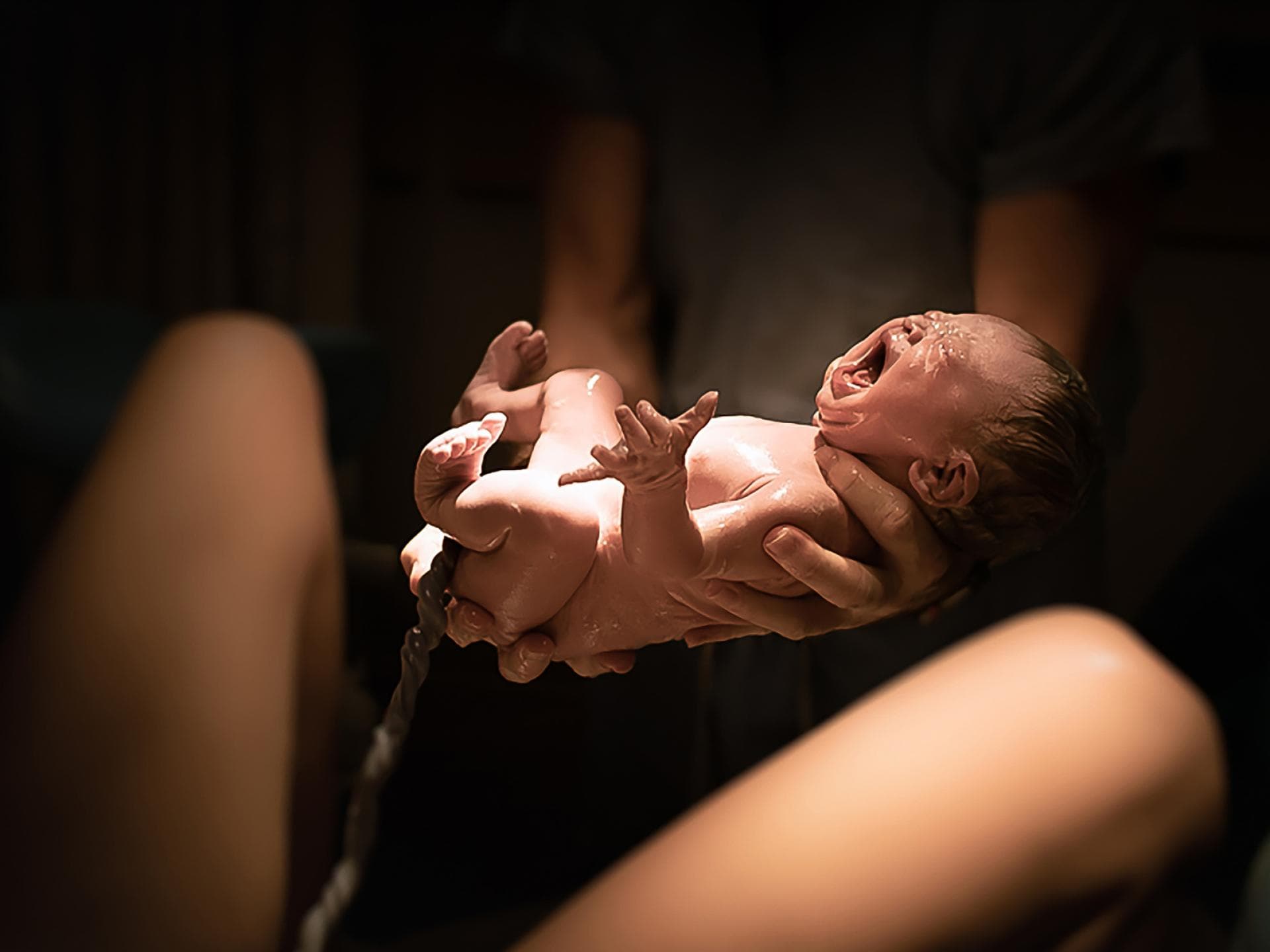 Bei einer Lotusgeburt werden die Nabelschnur und die Plazenta nach der Entbindung nicht, wie üblich, durchtrennt. Säugling mit Nabelschnur direkt nach der Geburt